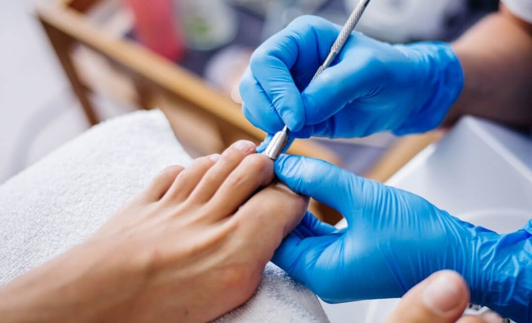 află când este recomandată pedichiura medicală